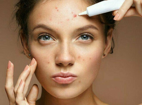 clearing the confusion :understanding Acne & its Causes - 기타
