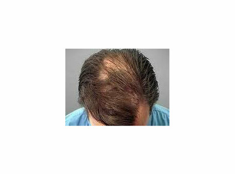 Losing Hair? Here's What You Need to Know—and How to Stop It - เสริมสวย/แฟชั่น
