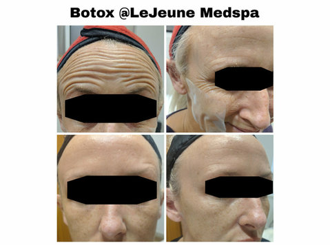 Revitalize Your Beauty at LeJuene Med Spa: Where Excellence - Krása/Móda