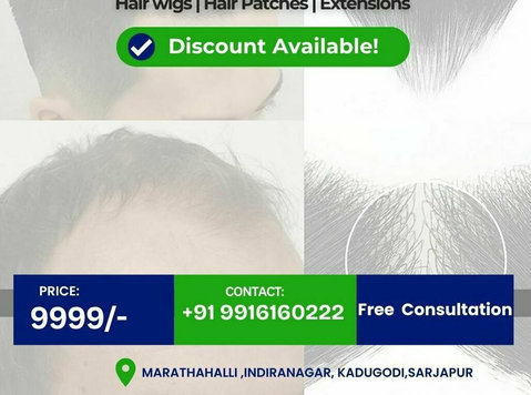 Fix Hair Loss the Smart Way: Safe and Natural - Ομορφιά/Μόδα