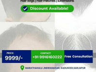 Fix Hair Loss the Smart Way: Safe and Natural - Красота/мода