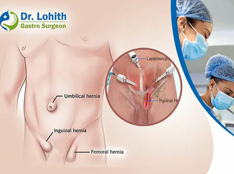 Best Doctor for Hernia Surgery in Sarjapur Road - Övrigt