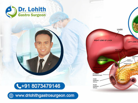 Best Gall Bladder Surgeon in Sarjapur Road - อื่นๆ
