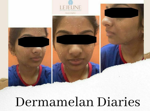 Embark on a journey to radiant skin with Lejeune Medspa, you - Services: Other