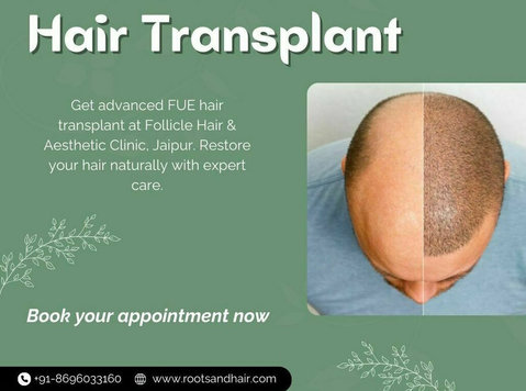 Affordable Fue Hair Transplant - Άλλο