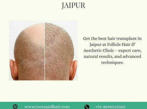 Best hair transplant in jaipur - Drugo