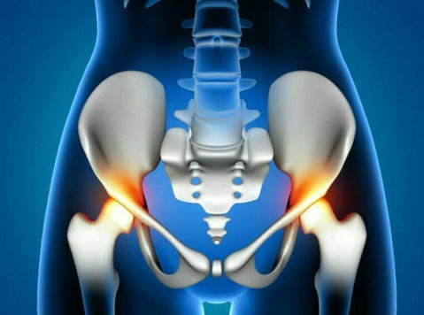 Jaipur Hip Replacement: Your Path to Pain-free Living - Muu