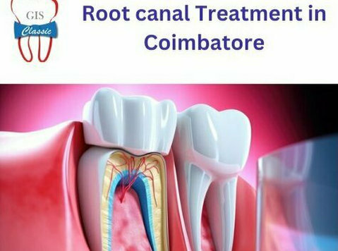 Root Canal Treatment in Coimbatore | Endodontist in Coimbato - Frumuseţe/Moda