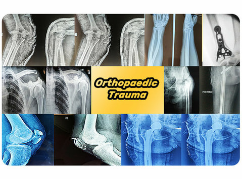 Speed up Your Recovery | Best Arthroscopic Surgeon in Noida - Ostatní