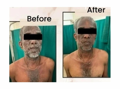 Say Goodbye to Skin Issues Dermatologist in Behala - دیگر