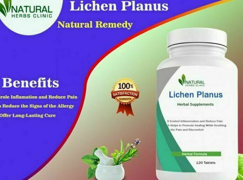 Natural Remedies for Lichen Planus - Moda/Beleza