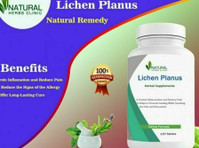 Natural Remedies for Lichen Planus - 美容/ファッション
