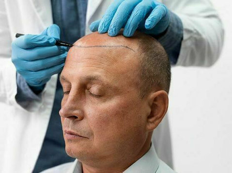 best surgical and nonsurgical Hair Restoration in Dubai - Красота/мода
