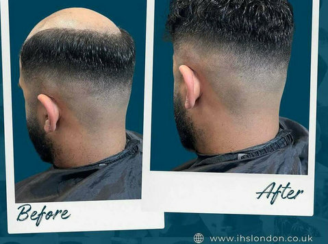Customised Hair Wigs for Men – Confidence Starts Here - دوسری/دیگر