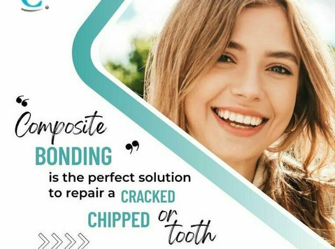 Composite bonding is the perfect solution to repair a cracke - Uroda/Moda