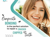 Composite bonding is the perfect solution to repair a cracke - Moda/Beleza