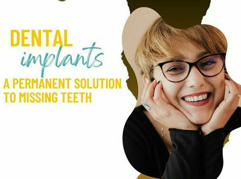 Dental implants - A permanent solution to missing teeth - Moda/Beleza
