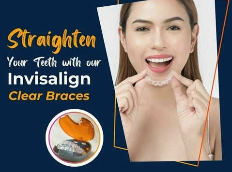 Straighten Your Teeth with our Invisalign Clear Braces - 美丽与时尚