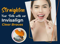 Straighten Your Teeth with our Invisalign Clear Braces - Uroda/Moda
