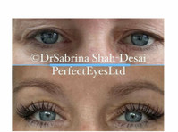 Upper Eyelid Blepharoplasty - Beauty/Fashion
