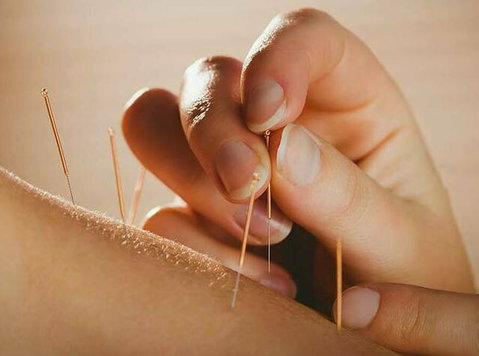 You no longer need to look for Beckenham Acupuncture because - Övrigt