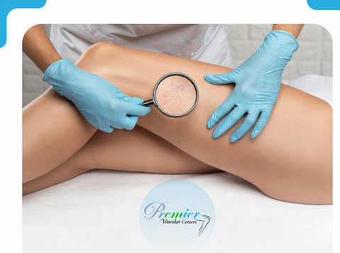 Where Can You Find Vascular Experts in Boca Raton? - Beauté