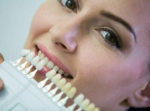 Dental Veneers Special – Restore Confidence in Your Smile - Làm đẹp/ Thời trang