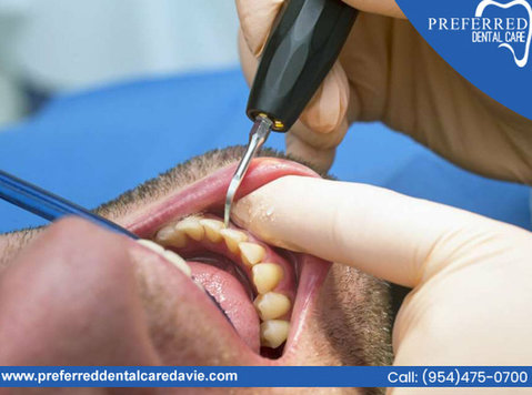 Protect Your Smile with Expert Cavity Protection Services - Muu