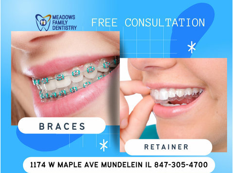🌟 Unlock the Power of a Beautiful Smile with Braces! 🌟 - Moda/Beleza