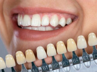 Cosmetic Dentistry In Chicago - دیگر