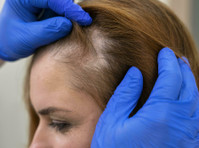 Find Best Hair Loss Clinic in Boston - skønhed/mode
