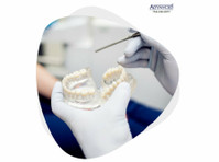 Dental Implants in Michigan - Altele