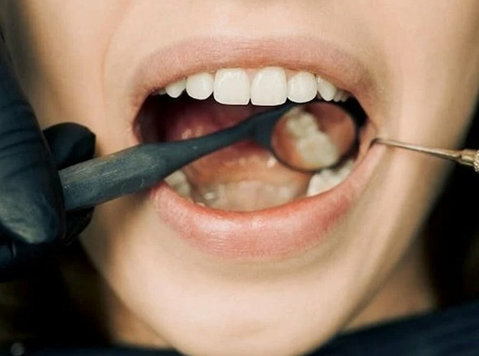 Dental Veneers Philadelphia - Diğer