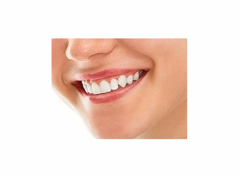 The Colony Teeth Whitening - Krása a móda