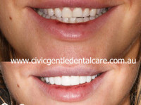 Civic Gentle Dental Care (1) - Dentists