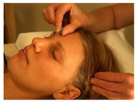 Soothe Acupuncture and Tui Na Bodywork (3) - Akupunktūra