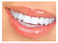 ismile dental centre (4) - Dentisti