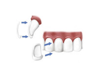 ismile dental centre (8) - Zubní lékař