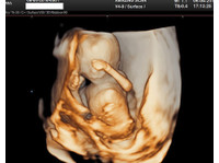 Amazing Scan (1) - Gynaecologists