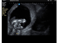 Amazing Scan (2) - Gynaecologists