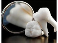 Wisdom Teeth Dentist (3) - Dentistas
