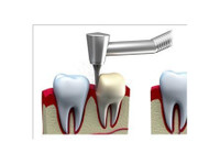Chapel Gate Dental (4) - Zobārsti