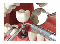 Bond Street Dental Implants Toronto (3) - Terveysopetus