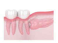 Bond Street Dental Implants Toronto (4) - Terveysopetus