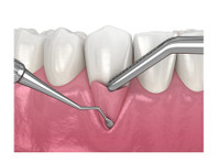Bond Street Dental Implants Toronto (5) - Terveysopetus