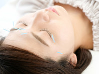 Acusessions Acupuncture Clinic (3) - Βελονισμός