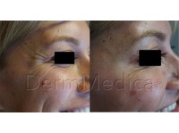 DermMedica (1) - Beauty Treatments