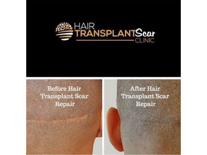 Hair Transplant Scar Clinic - Fryzjer
