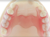 Parada Dentures Fergus (2) - Οδοντίατροι