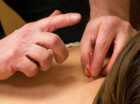 NW Chiropractic and Massage (7) - Akupunktura